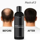 ELLHOY Magic Colour Hair Concealer Spray 100ML (Pack of 2)