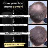 ELLHOY Magic Colour Hair Concealer Spray 100ML (Pack of 2)