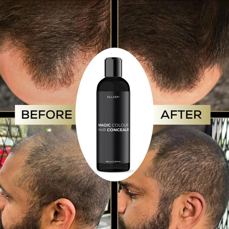 ELLHOY Magic Colour Hair Concealer Spray 100ML (Pack of 2)